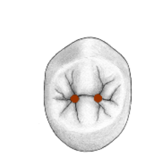 <p>Depression or concavity</p>