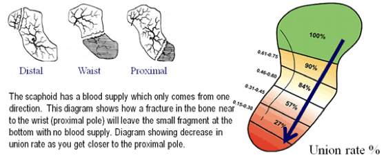 <ul><li><p>Mechanism</p><ul><li><p>Fall on outstretched hand</p></li></ul></li><li><p>Patient report</p><ul><li><p>Pain in anatomic snuffbox</p></li><li><p>Pain with ROM</p></li><li><p>Pain with weight bearing</p></li></ul></li><li><p>Treatment</p><ul><li><p>Conservative</p><ul><li><p>Non-displaced fracture < 3 weeks old</p><ul><li><p>Thumb-spica (used for anything that affects radial side of the wrist) splint for immobilization (88-95% healing rate)</p></li><li><p>Follow up every 3-4 weeks for splint change and X-ray</p></li><li><p>Continue conservative splinting or discuss surgery if non-union</p></li></ul></li></ul></li><li><p>Surgical</p><ul><li><p>ORIF</p></li></ul></li></ul></li></ul><p></p>