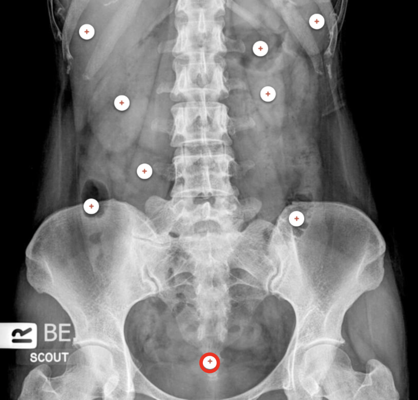 <p>what structure is the red circle labeling?</p>