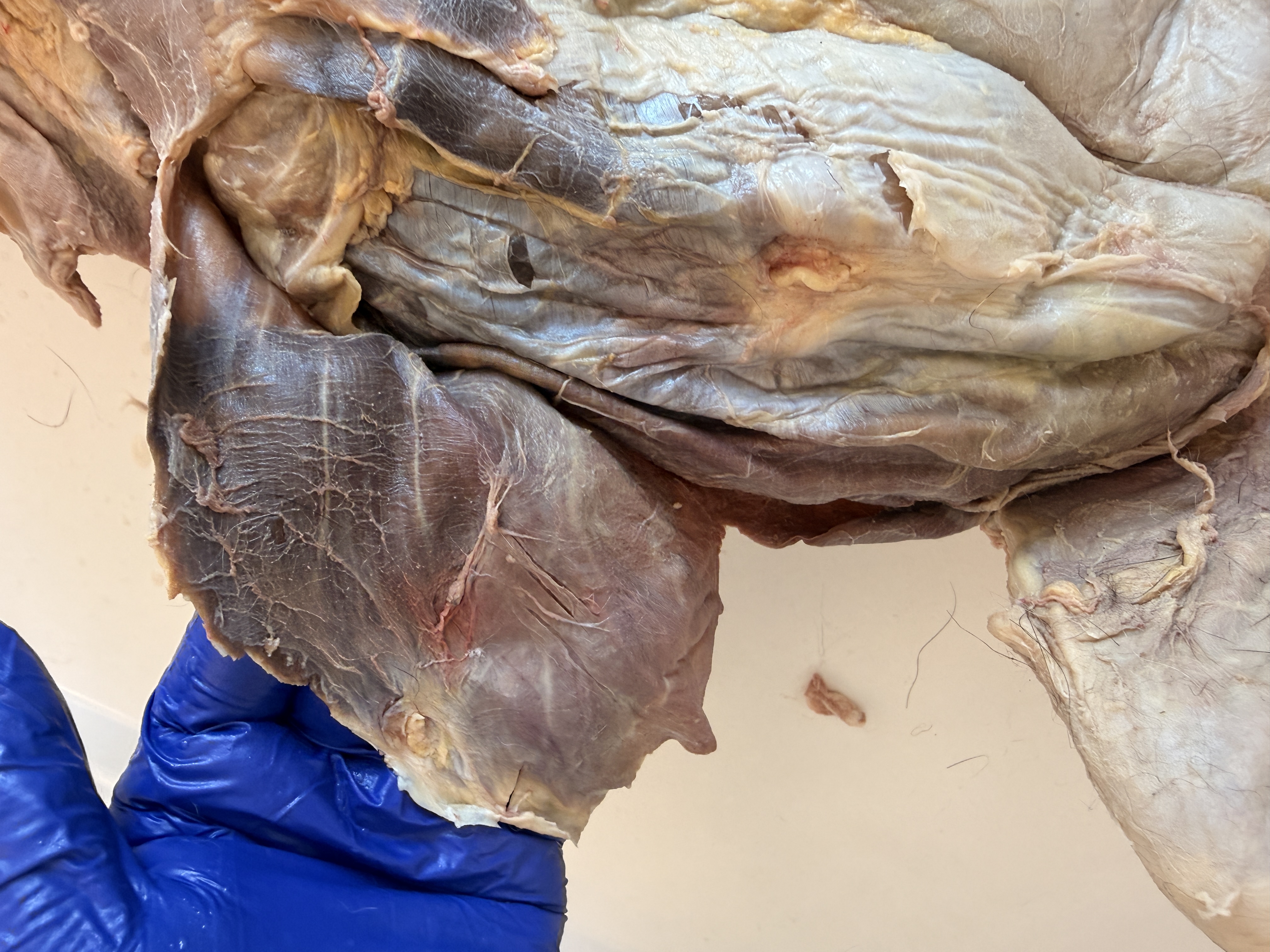 <p>Name this muscle </p>
