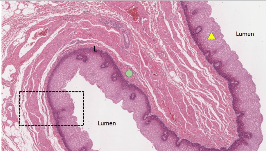 <p>Name the important structures of the Mucosa of the esophagus</p>