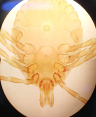 <p>Ixodidae, Adulto Hembra de <em>Amblyomma americanum</em></p>