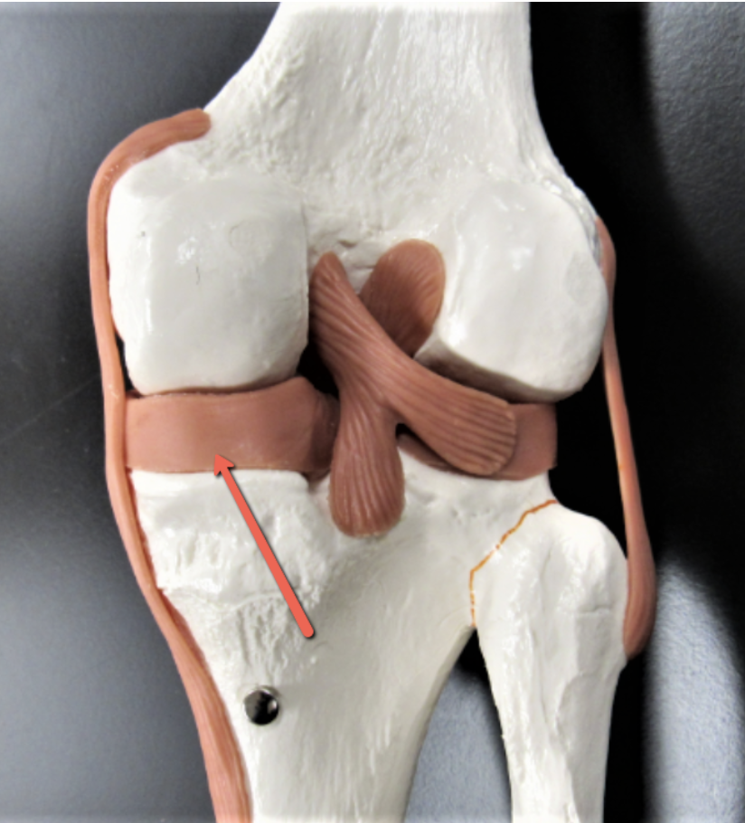 <p><span><strong>Identify the structure indicated by the pointer.</strong></span></p>
