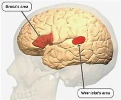 <p>Impaired speech production, comprehension intact.</p>