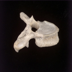 <p>Name of vertebrae and #bones</p>