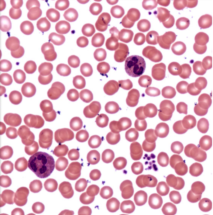 <p>ID Tissue (Be Specific)</p>