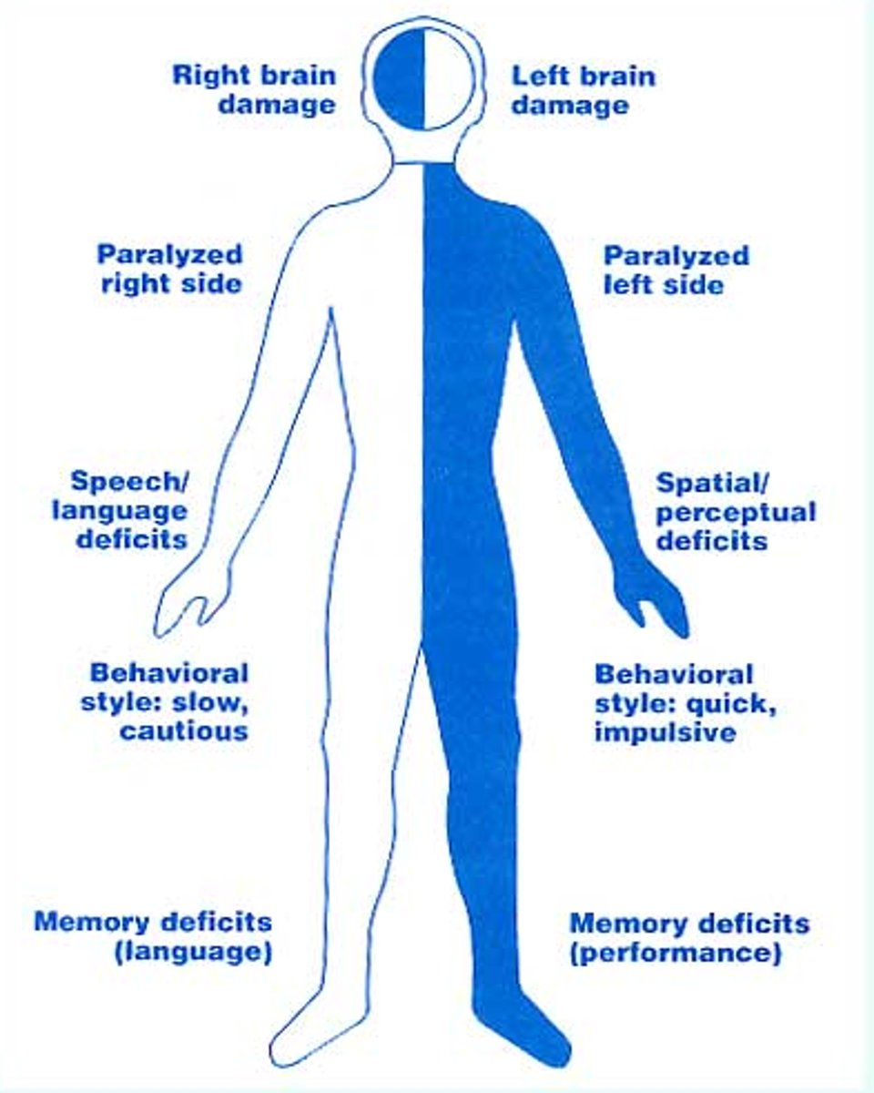 <p>One-sided paralysis from brain damage.</p>