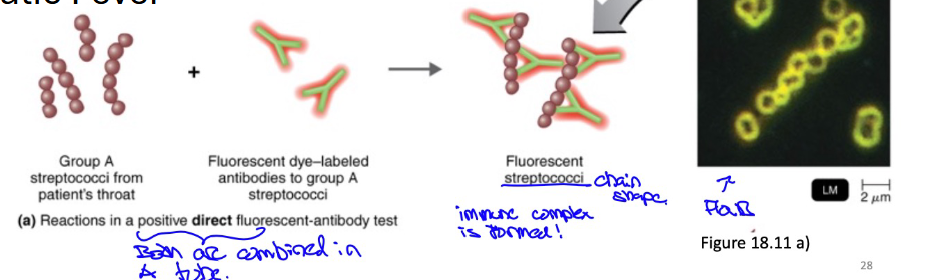 <p>Looking for a specific antigen (Pathogen) in a patient’s serum sample</p><p>Application/Use: To identify <u>GAS</u> (Group A streptococcus) from a patient’s throat sample</p><p>A diagnosis test for : <u>Streptococcus pyogenes</u> (GAS) → Strep throat/ Scarlet Fever/Rheumatic Fever</p>