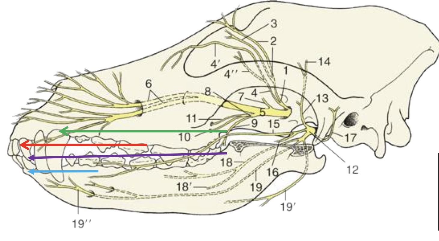 <p>what is the purple arrow showing?</p>