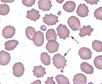 <p>name the type of RBC</p>