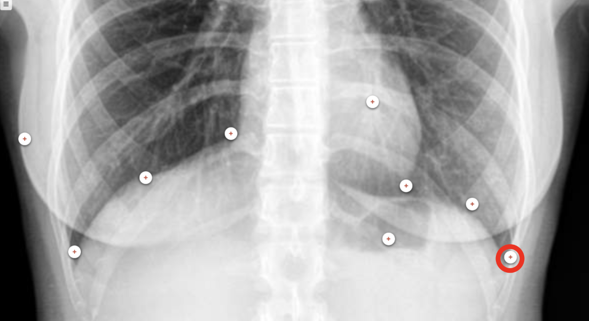<p>what structure is the red circle labeling?</p>