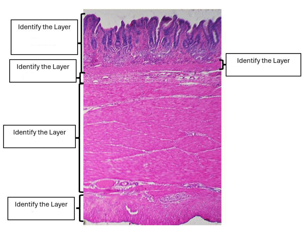 <p>identify the organ </p>