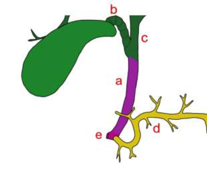 <p>A</p>