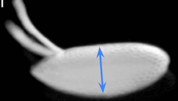 <p>Which body axis is represented in the image?</p>