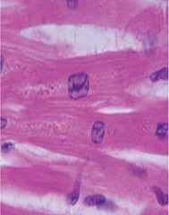 <p>cardiac muscle</p>