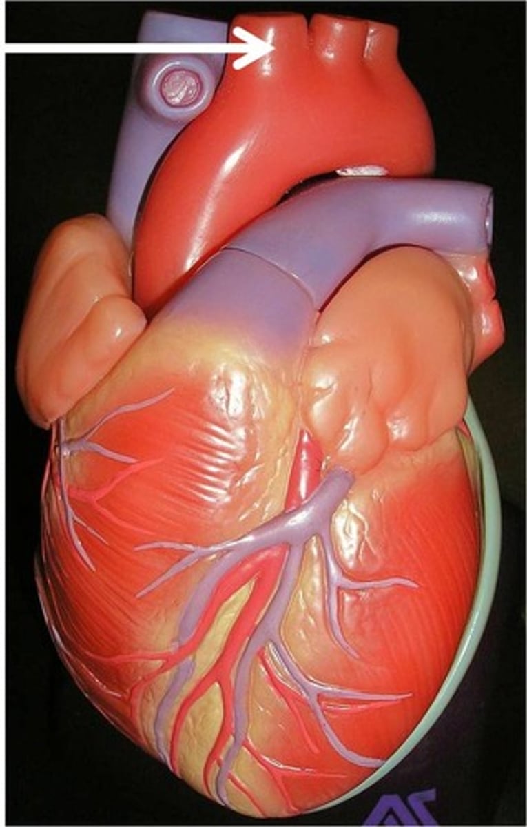 <p>The first major branch off of the aorta and the major artery to the forelimbs and head.</p>