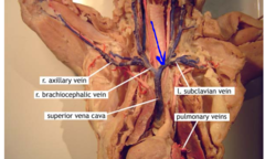 <p>r & l brachiocephalic vein</p>