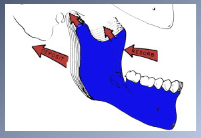 <p><span>MATURATIONAL AND AGING CHANGES- LATE MANDIBULAR GROWTH</span></p>