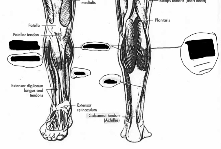 <p>Label these muscles in the lower leg</p>