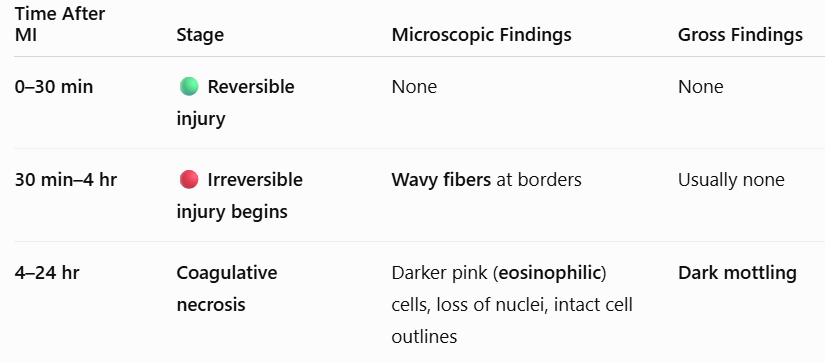 <p><span style="background-color: transparent; font-family: "Times New Roman", serif;"><strong>4–24 hours:</strong> <strong>Micro:</strong> Coagulative necrosis (darker pink cells, loss of nuclei, intact outlines). <strong>Gross:</strong> Dark mottling.</span></p>