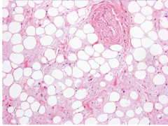 <p>Identify the type of connective tissue</p>