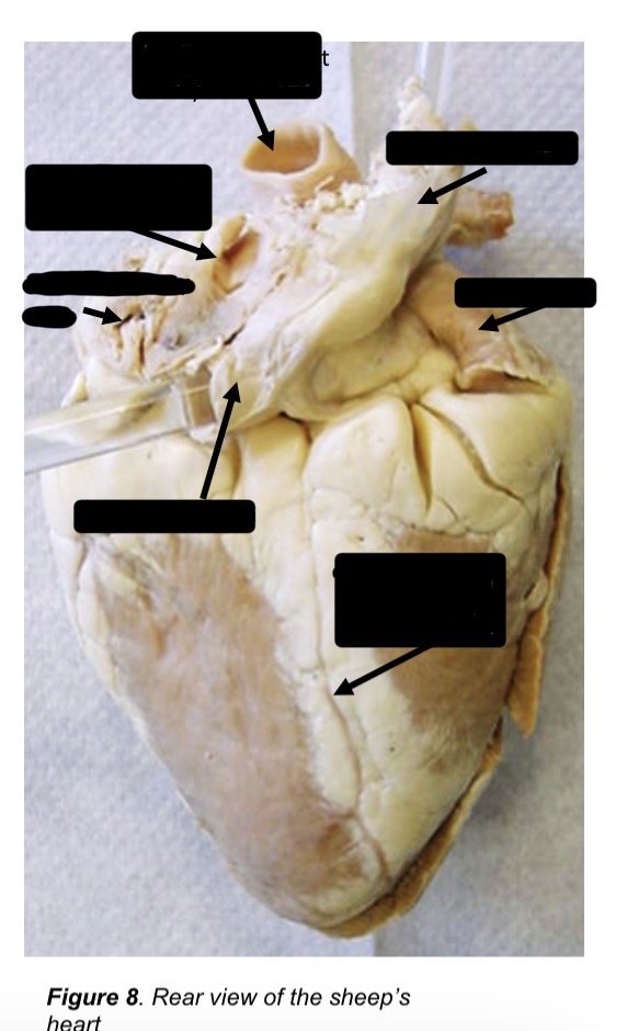 <p>Label the heart</p>