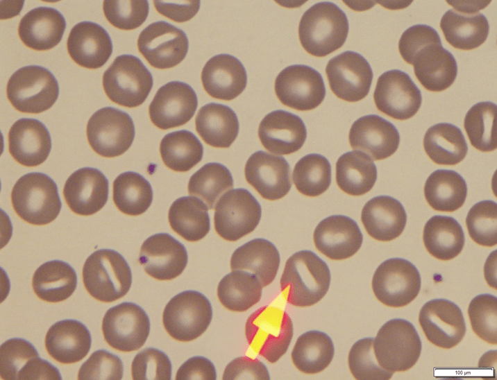 <p>What is this RBC shape?</p>