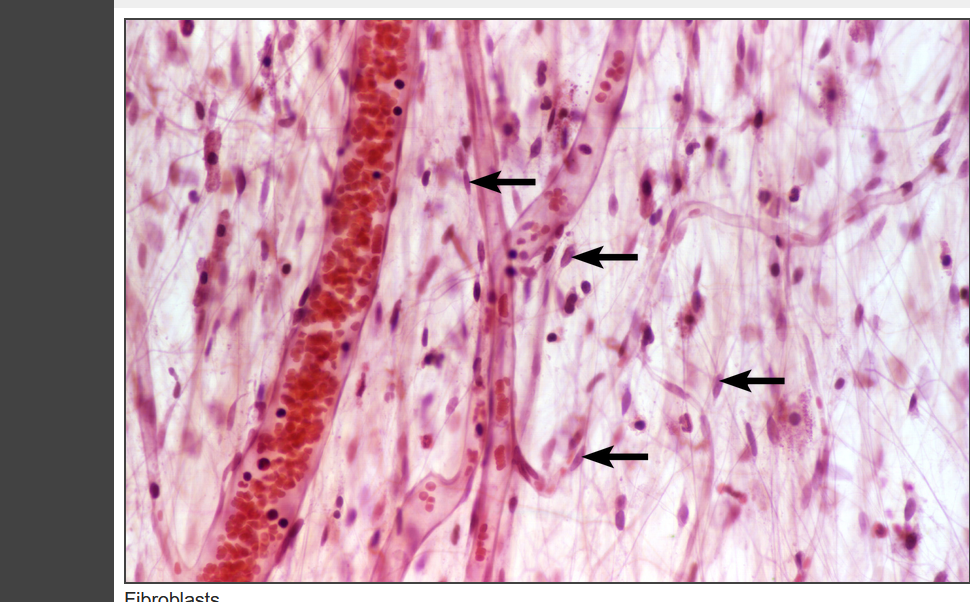 <p>what tissue type is this</p>
