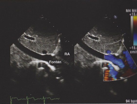<p>Describe the findings in this image.</p>