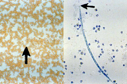 <p>Identify the parasite</p>
