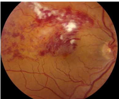 <p>Describe the picture</p>