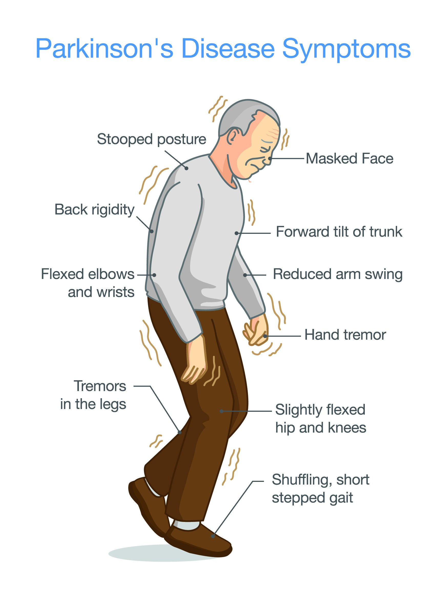 <p>Parkinson’s disease is a degenerative disease that leads to: (4 symptoms)</p>