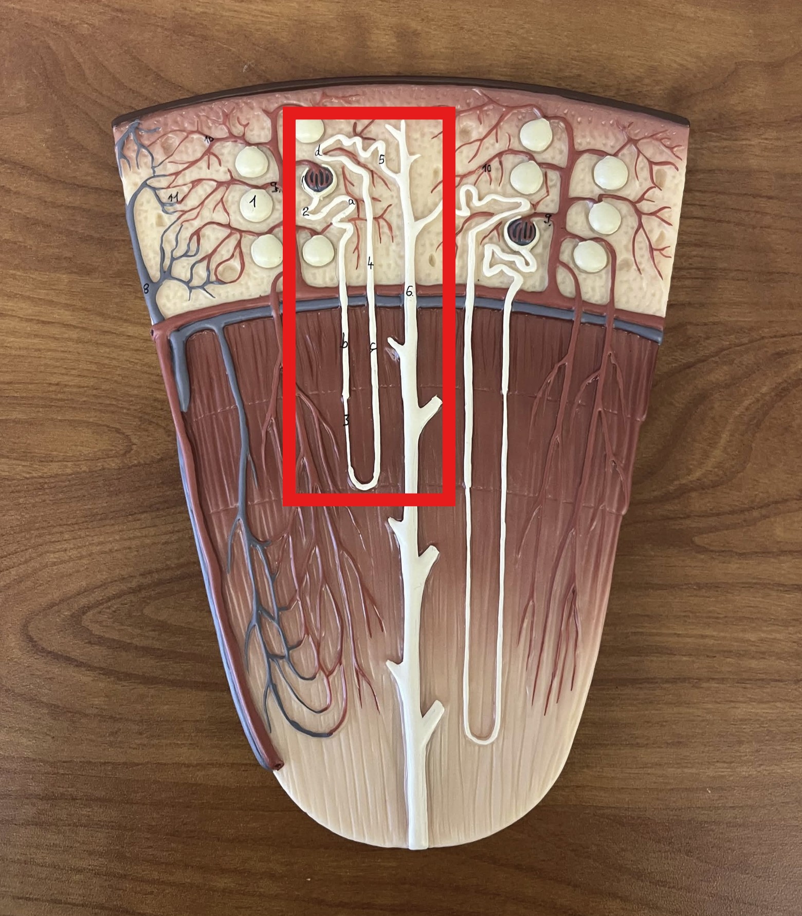 <p>Which type of nephron is this?</p>