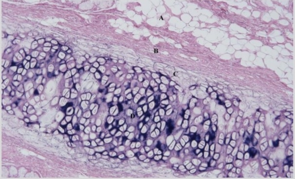 <p>NTK: what type of cartilage is this </p>
