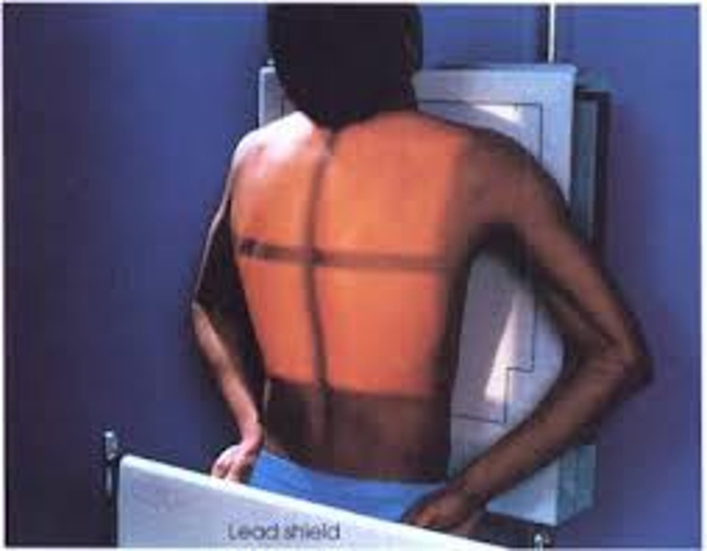 <p>- What exam is this?</p><p>- What is this exam used for?</p><p>- What is the SID?</p><p>- Is the patient shielded?</p><p>- How is the patient positioned?</p><p>- Why is the patient's shoulder rolled forward?</p><p>- What is the CR?</p><p>- What are the breathing instructions?</p><p>- What anatomy is demonstrated?</p>
