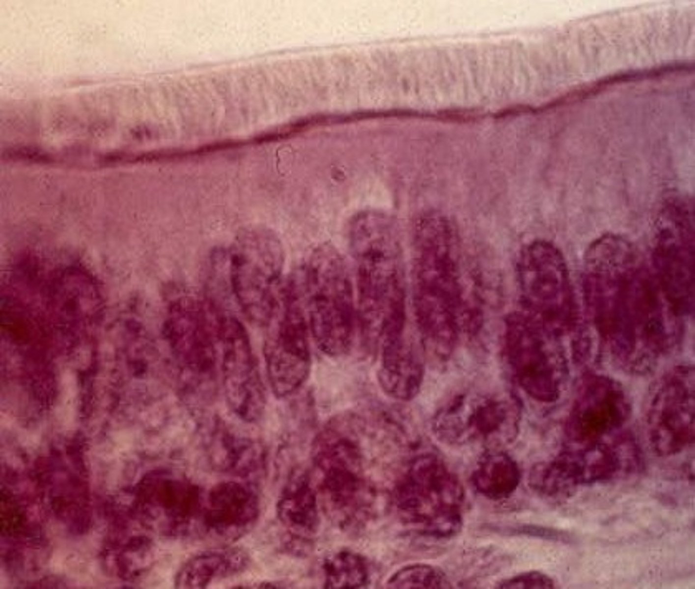 <p>Pseudostratified Columnar</p>