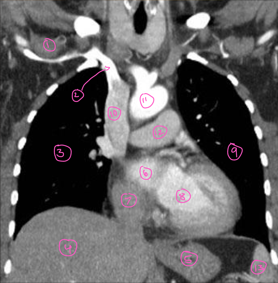 <p>The structure labeled 3 in this image is:</p>