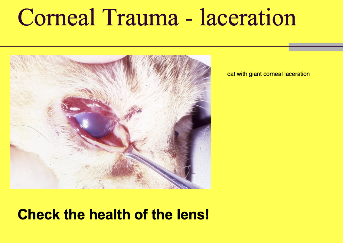 <p>involvement of the lens.</p>