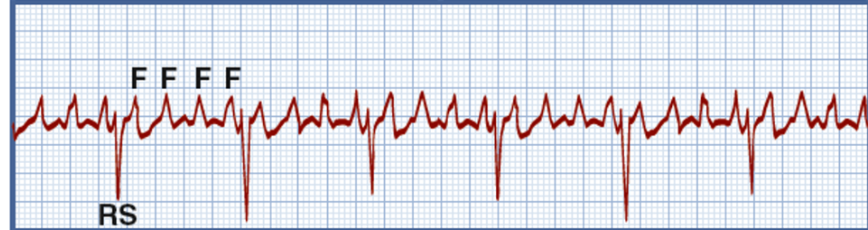 <p>What rhythm is this?</p>