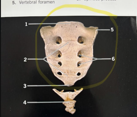 <p>What bone is circled in yellow?</p>