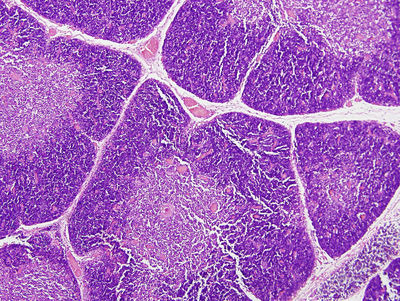 <p>Thymus</p>