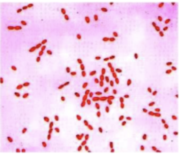 <p>What do you see under the microscope? </p>