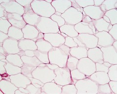 <p>A body tissue that provides support for the body and connects all of its parts</p>