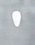 <p>What is this? Normal or abnormal sperm?</p>