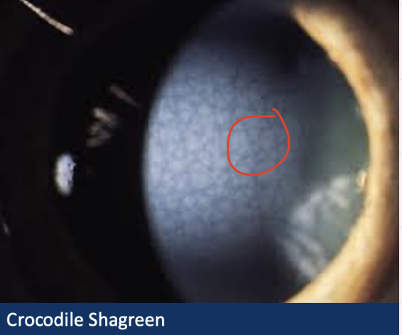 <p>Describe and give diagnosis</p>