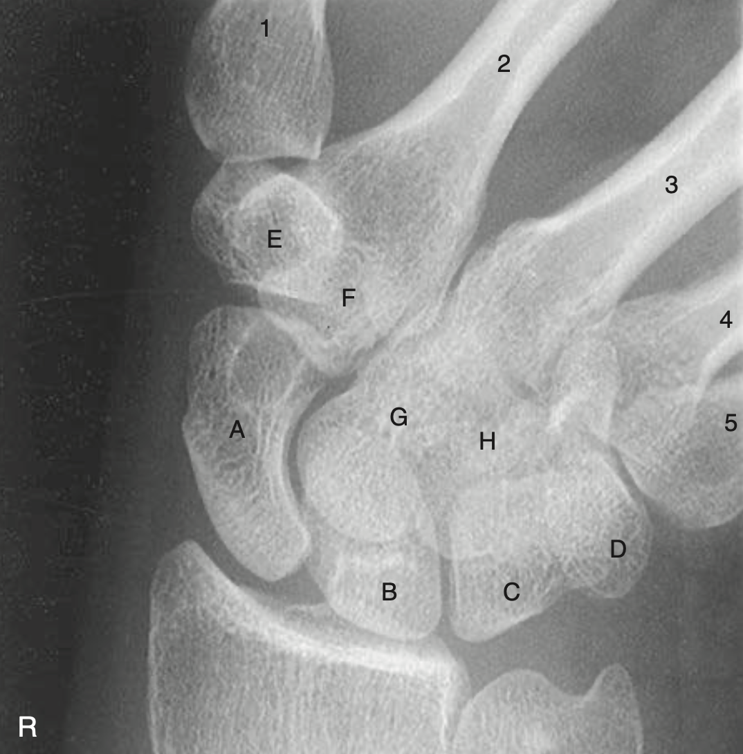 <p>B</p>