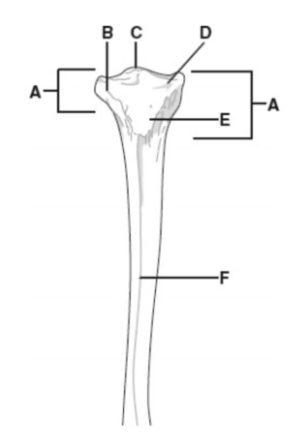 <p>D</p>