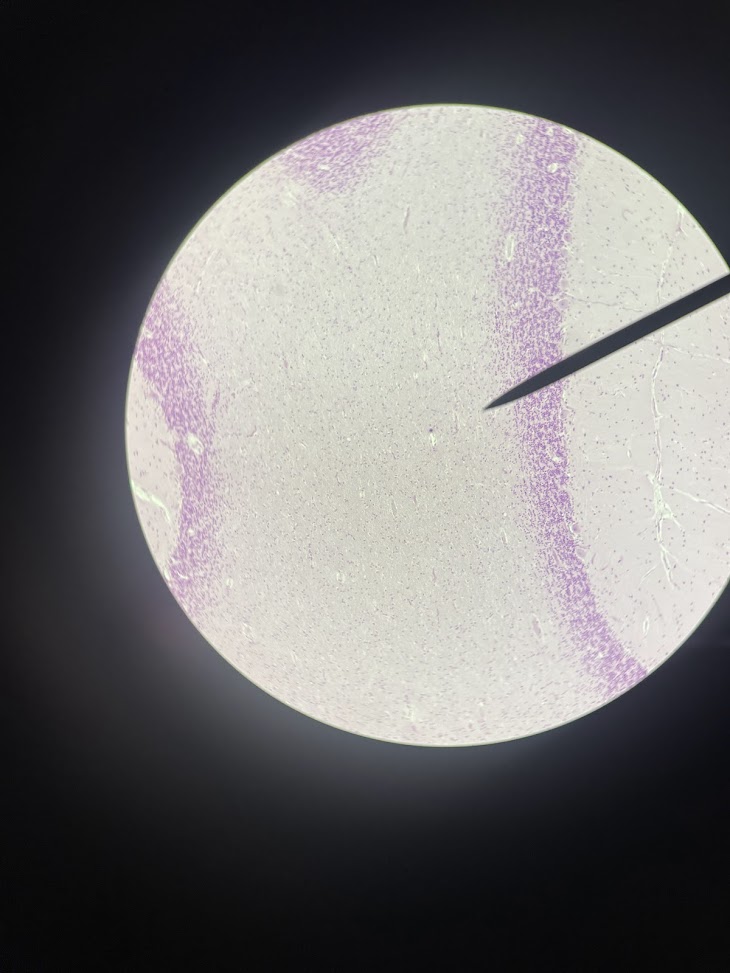 <p>tissue type (cerebellum)</p>