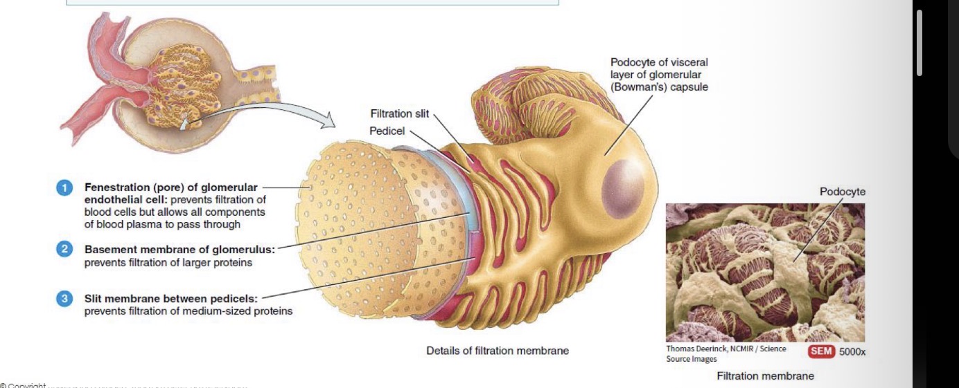 <p>Fenestrated endothelium: prevents filtration of blood cells, but allows all components of blood plasma to pass through</p><p>Basement membrane: prevents filtration of larger proteins</p><p>Podocyte pedicels: prevents filtration of medium sized proteins</p>