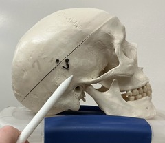 <p>What bone is this?</p>